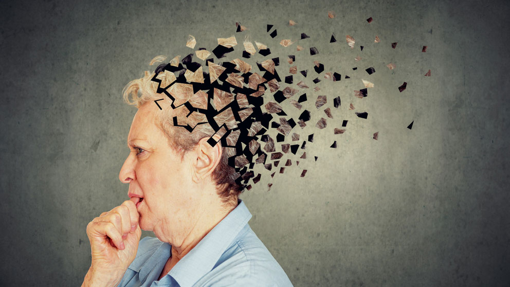 Kuinka uni vaikuttaa Alzheimerin riskiin?
